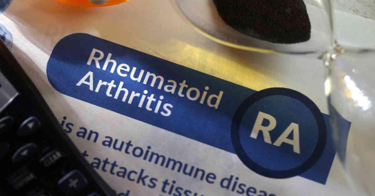 Rheumatoid Arthritis