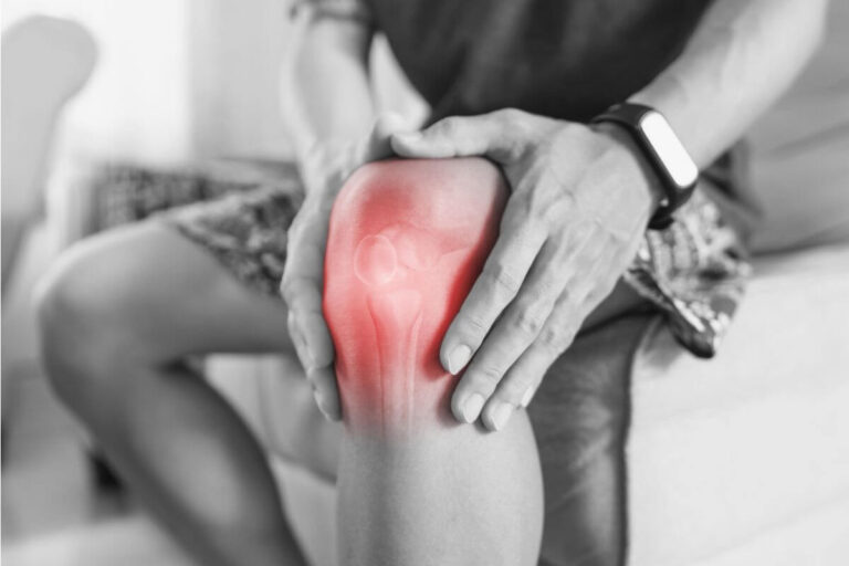 knee arthritis