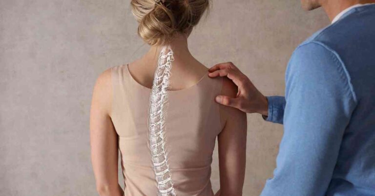 natural pain relief for scoliosis