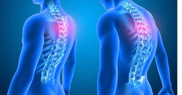 posture corrector for pain relief