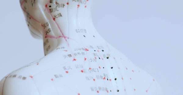 acupuncture for pain relief